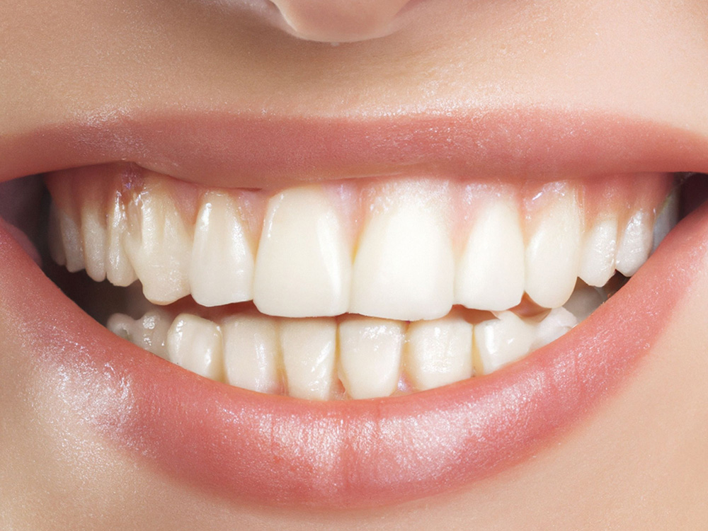 Image of the Best Cosmetic Dentist Near Me in Whittier Ca, Uptown Dental Group.