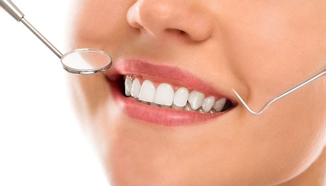 When Whitening May Not Be Enough